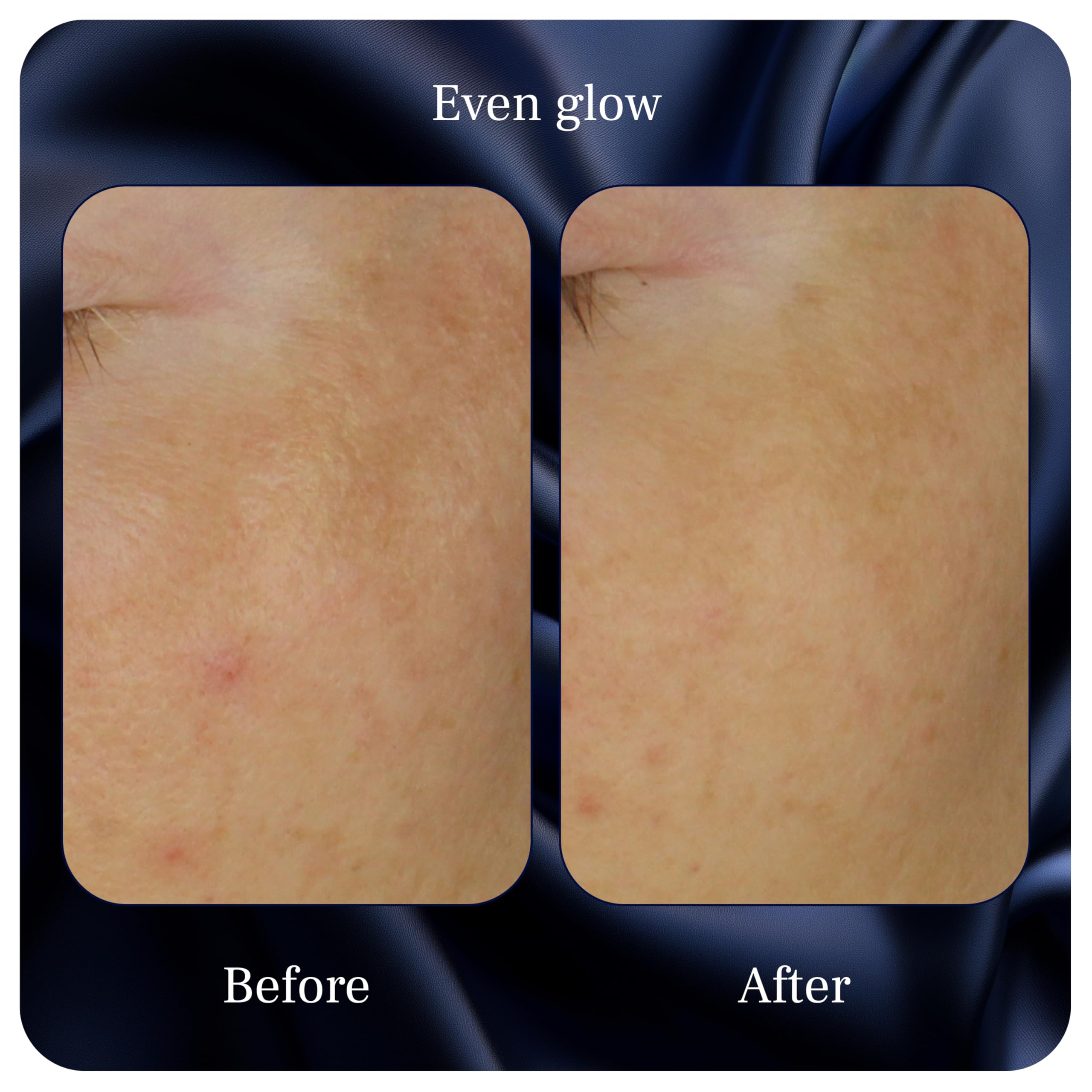 Even Glow by PUREANCE – Organic Vitamin C Serum for Dark Spots on Face & Body