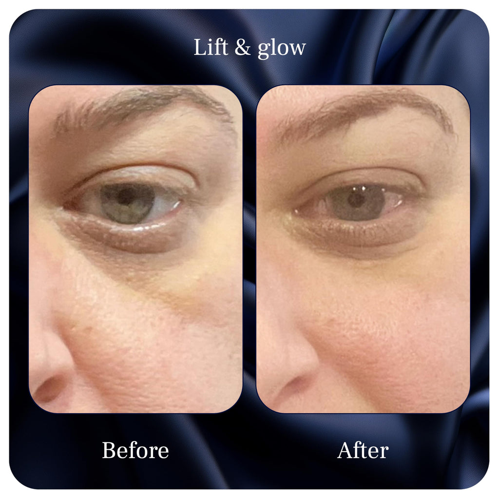 PUREANCE Lift and Glow Organic Eye Cream - Dark Circles, Puffiness and Fine Lines - 1 oz