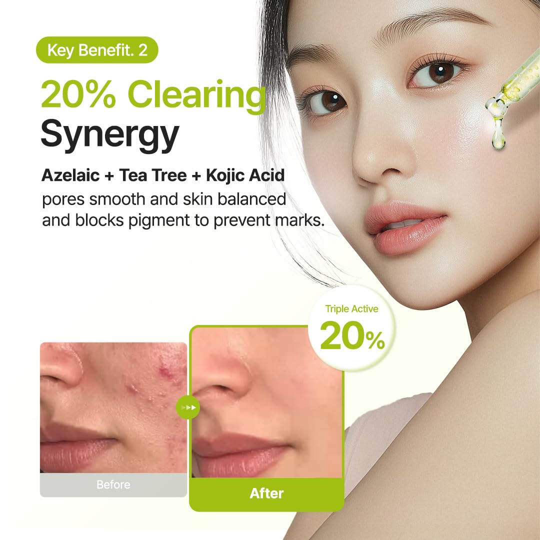 PURITO Azelaic Acid 10% + Kojic Acid + Tea Tree Serum – Acne & Marks (30mL)