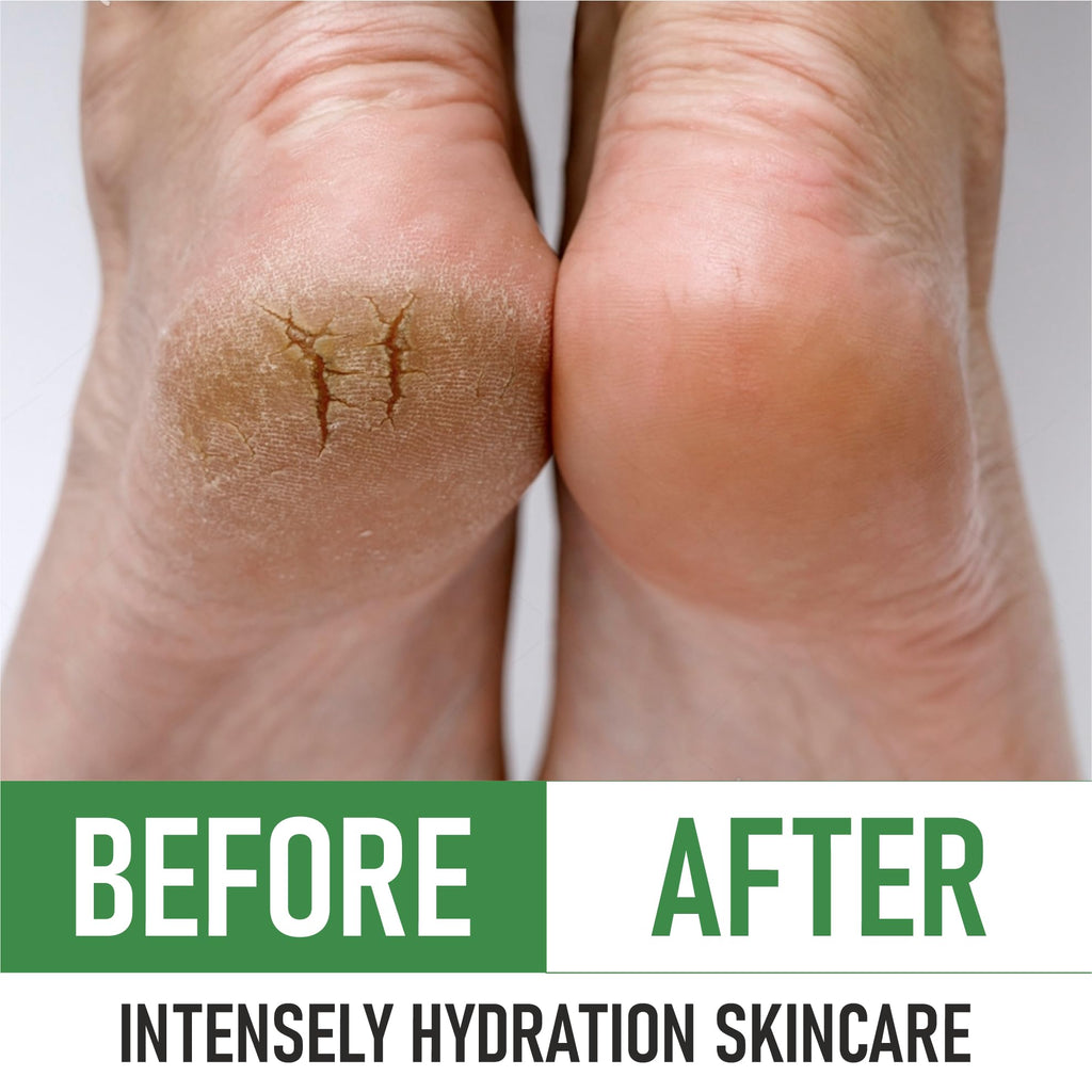 PurOrganica Urea 40% Foot Cream – USA-Made Moisturizing Foot Care (Pack of 2)
