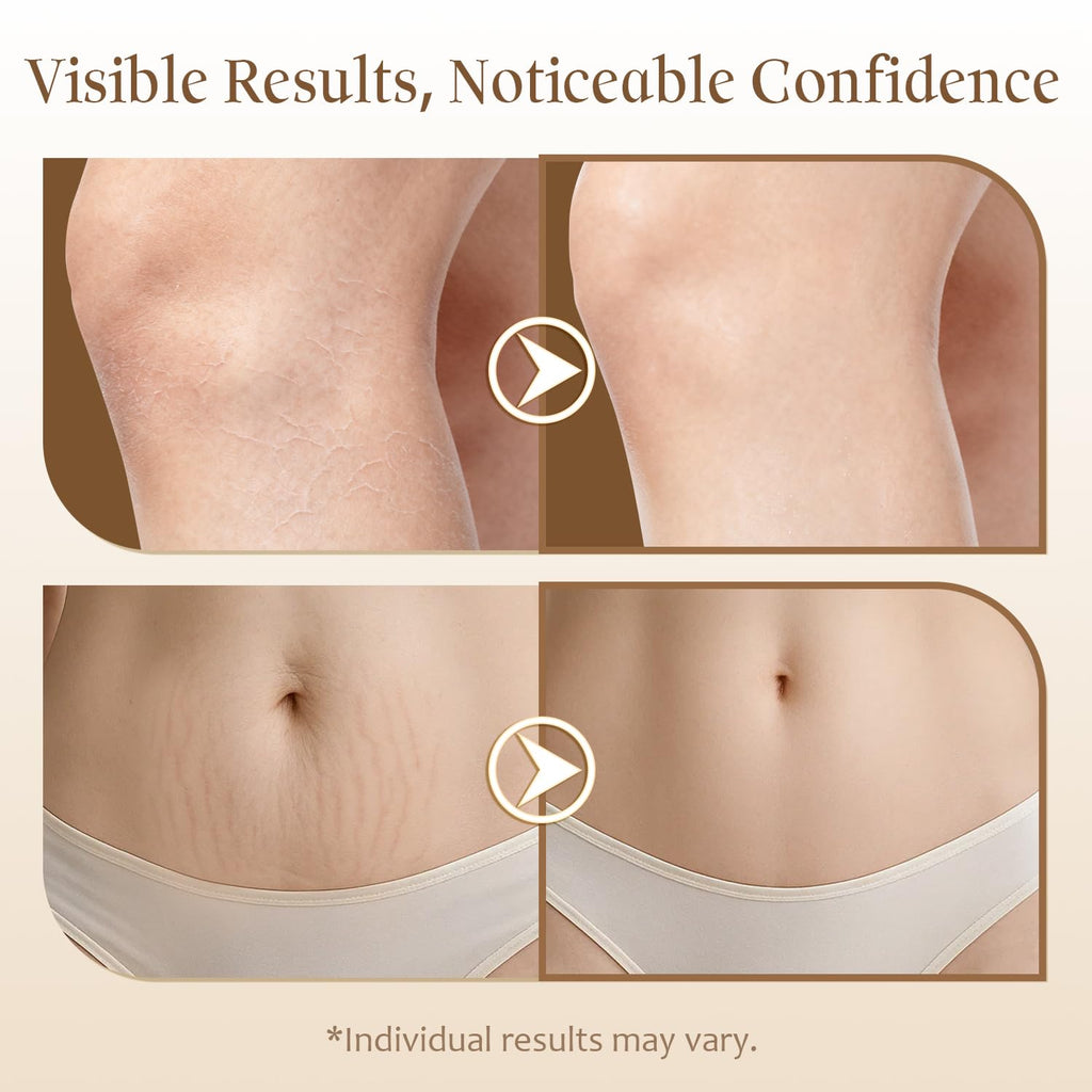 QAH Magic Body Firming Oil with Massage Roller – After Shower Hydration