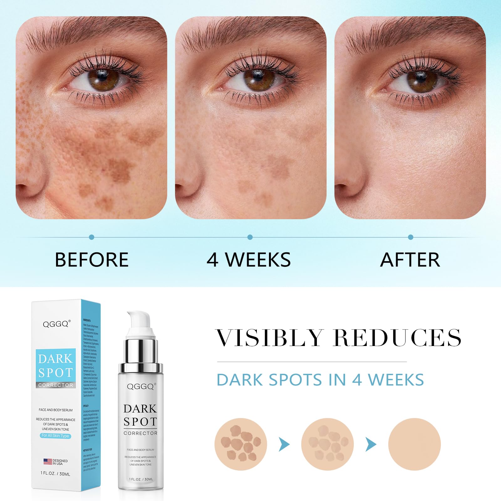 QGGQ Dark Spot Remover Serum – Niacinamide & Alpha-Arbutin for Face & Body