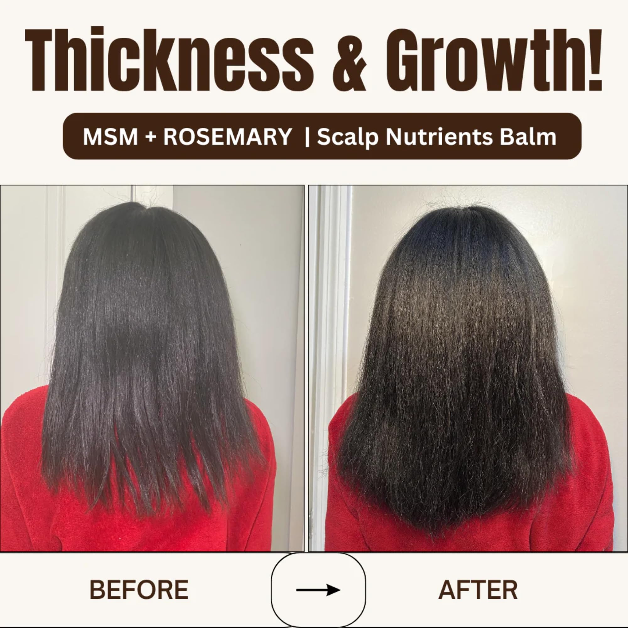 Qhemet Biologics MSM + Rosemary Scalp Nutrients Balm | Scalp Food for Healthy Hair | Vegan (4 oz)
