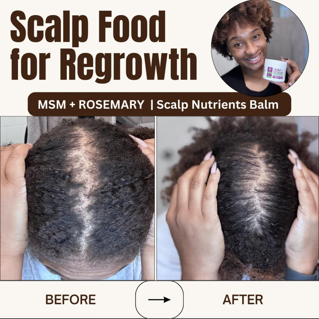 Qhemet Biologics MSM + Rosemary Scalp Nutrients Balm | Scalp Food for Healthy Hair | Vegan (4 oz)