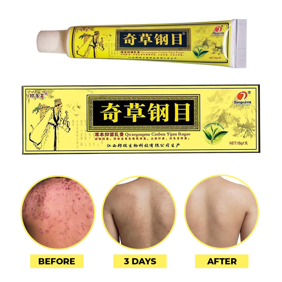 QICAOGANGMU Chinese Herbal Cream – Natural Skin Relief (Pack of 5) – Official Seller