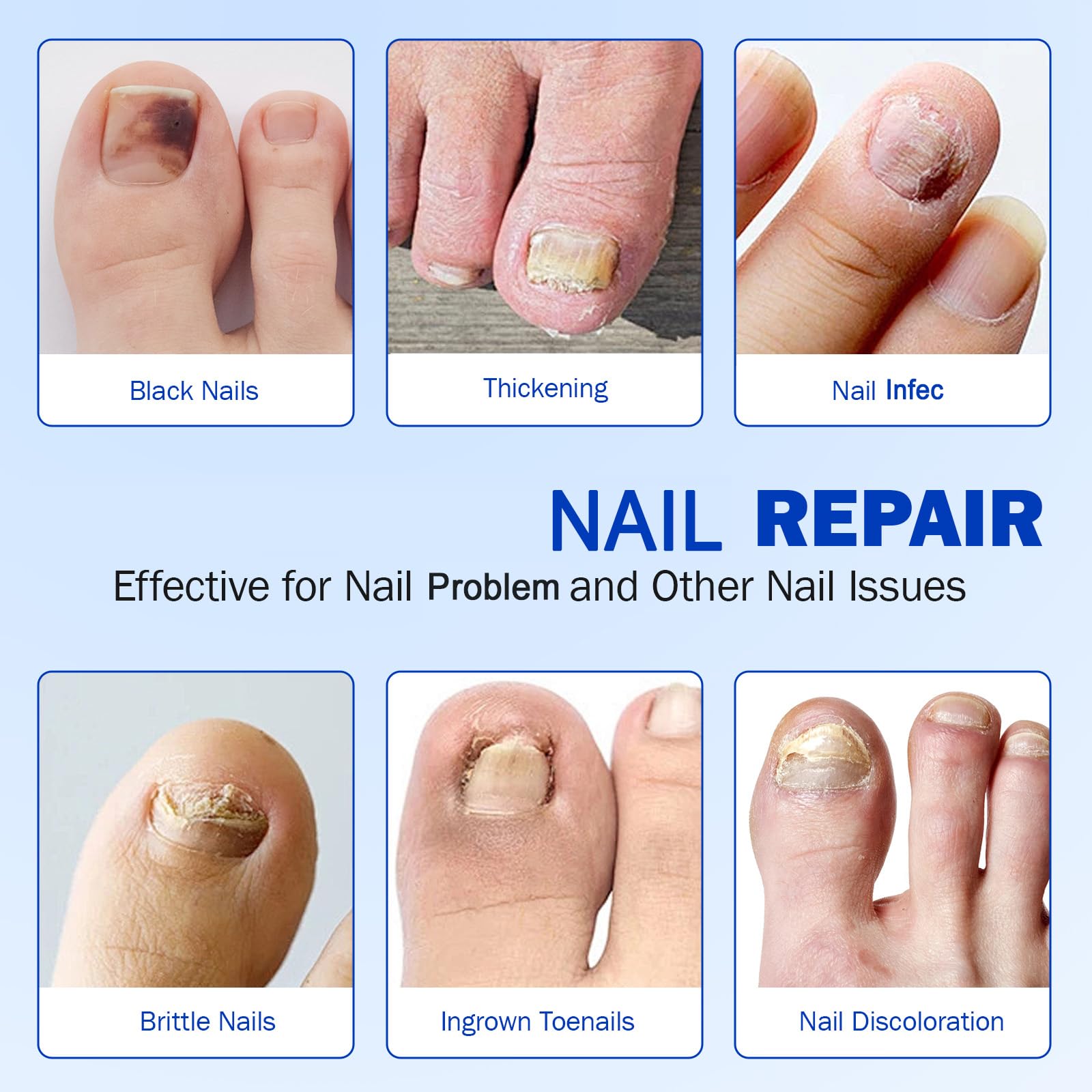 Qing Yo Nail Patches – 21 Pcs Overnight Nail Repair, Extra-Strength Patches for Thick, Discolored Nails