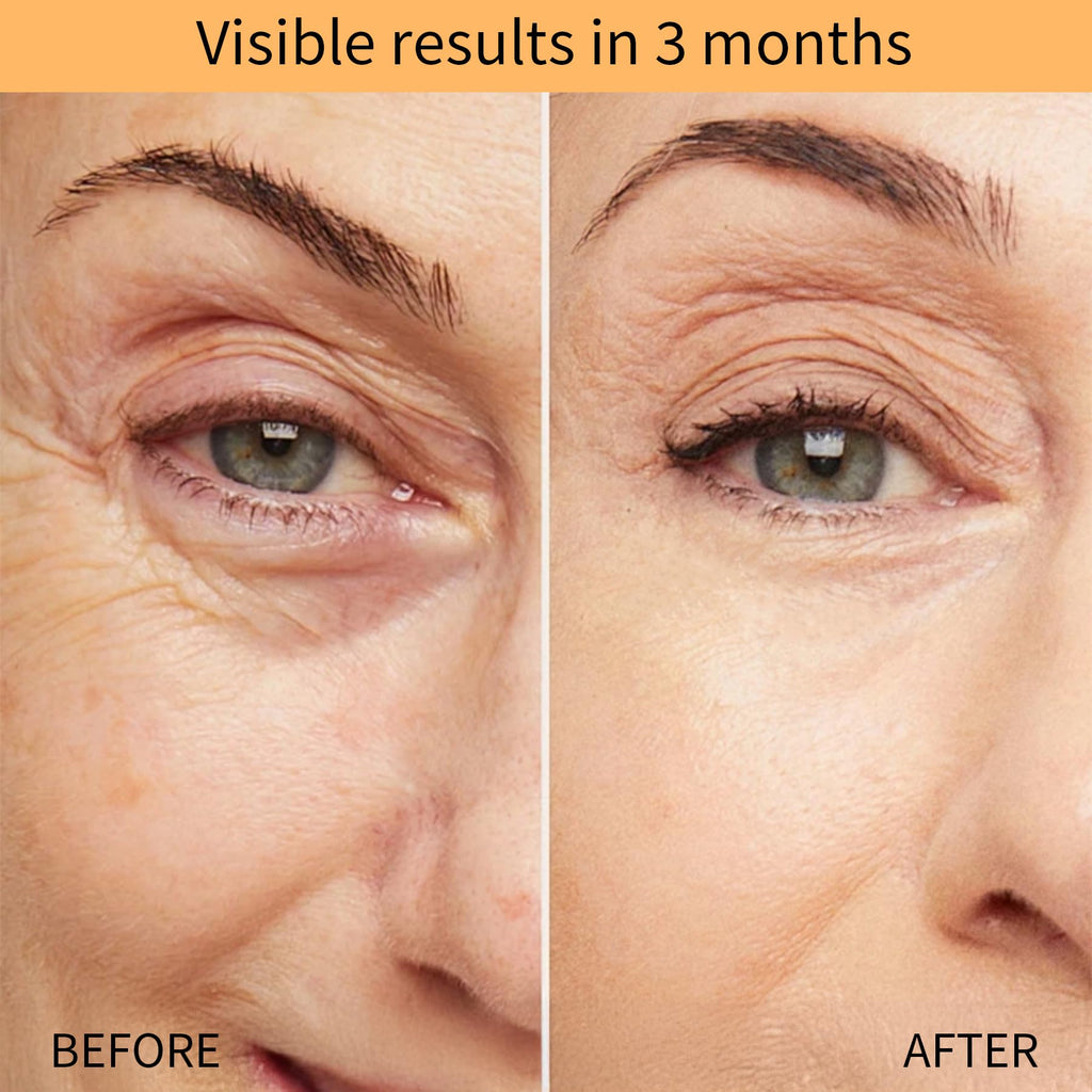 QINGLIN Polypeptide Tightening Cream – Firming Anti-Wrinkle Moisturizer for Face & Neck
