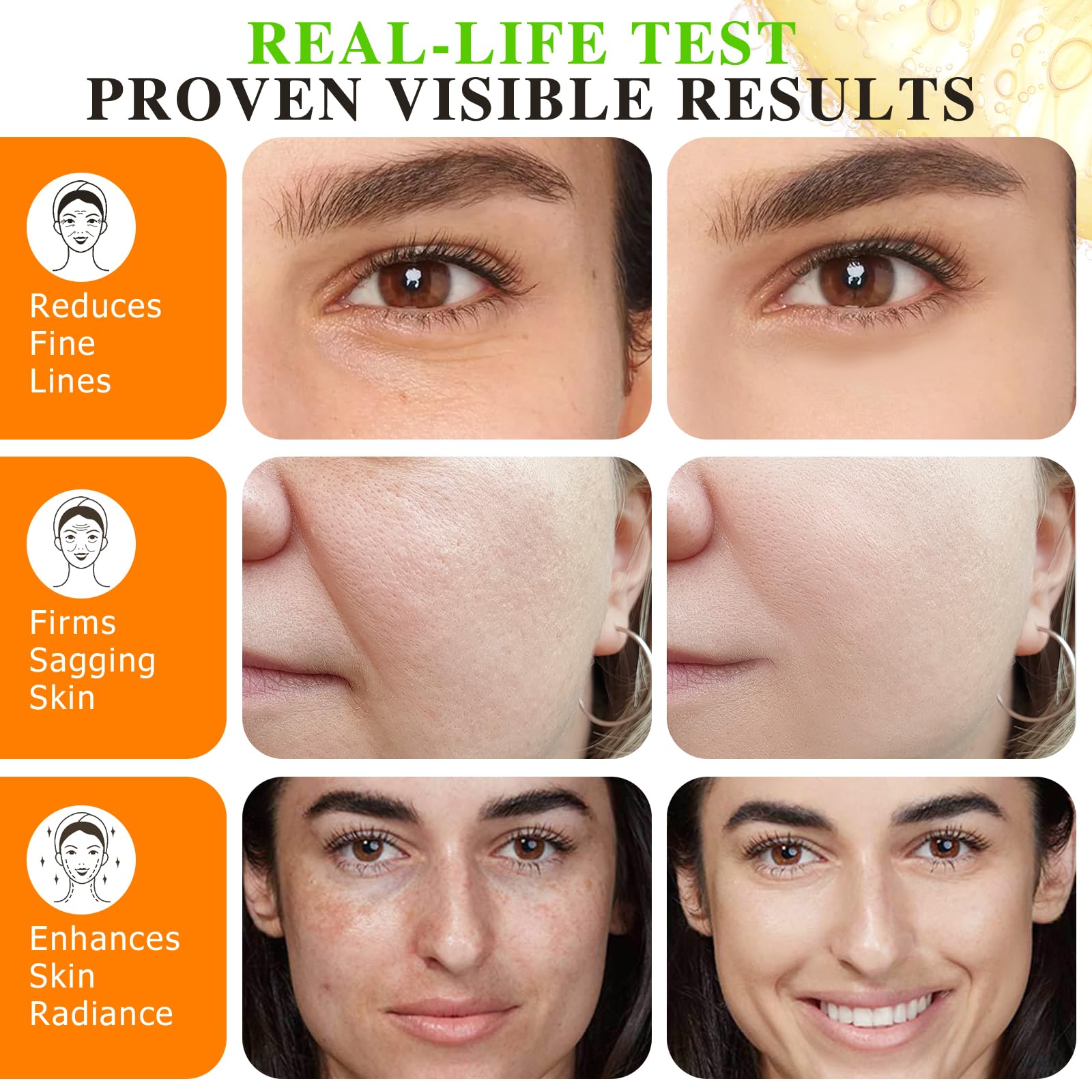 QJCWXIAOX Premium 20% Vitamin C Serum for Face & Neck - Anti-Aging, Hydration, 60ml