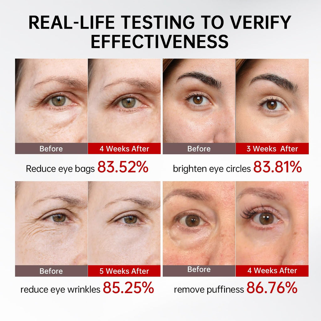 QQE Retinol & Caffeine Eye Serum with 360° Roller – Puffiness, Dark Circles & Wrinkle Support