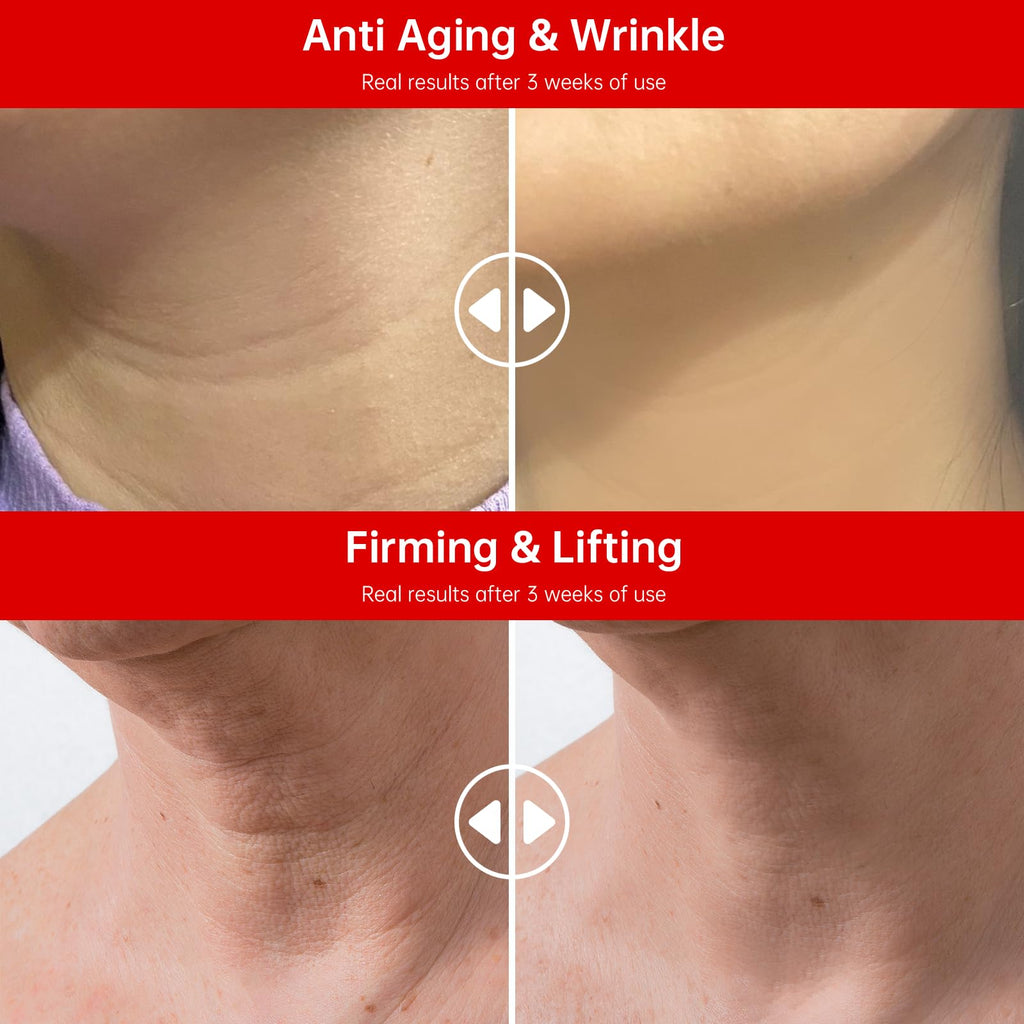 QQE Neck Firming Cream with Retinol, Collagen & Hyaluronic Acid | Instant Lift for Neck, Face & Chest