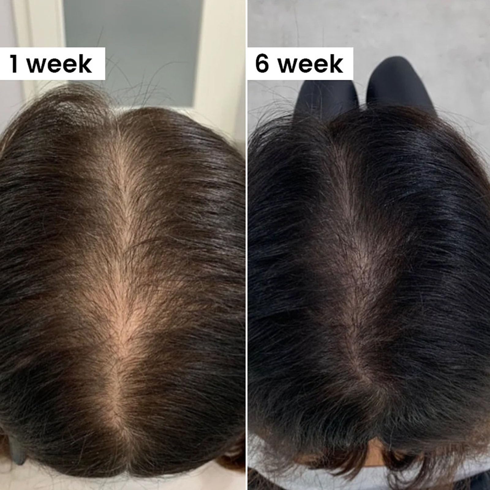 QUZOYU Thicair Hair Regrowth System – Volumizing Serum with Copper Peptides & Collagen