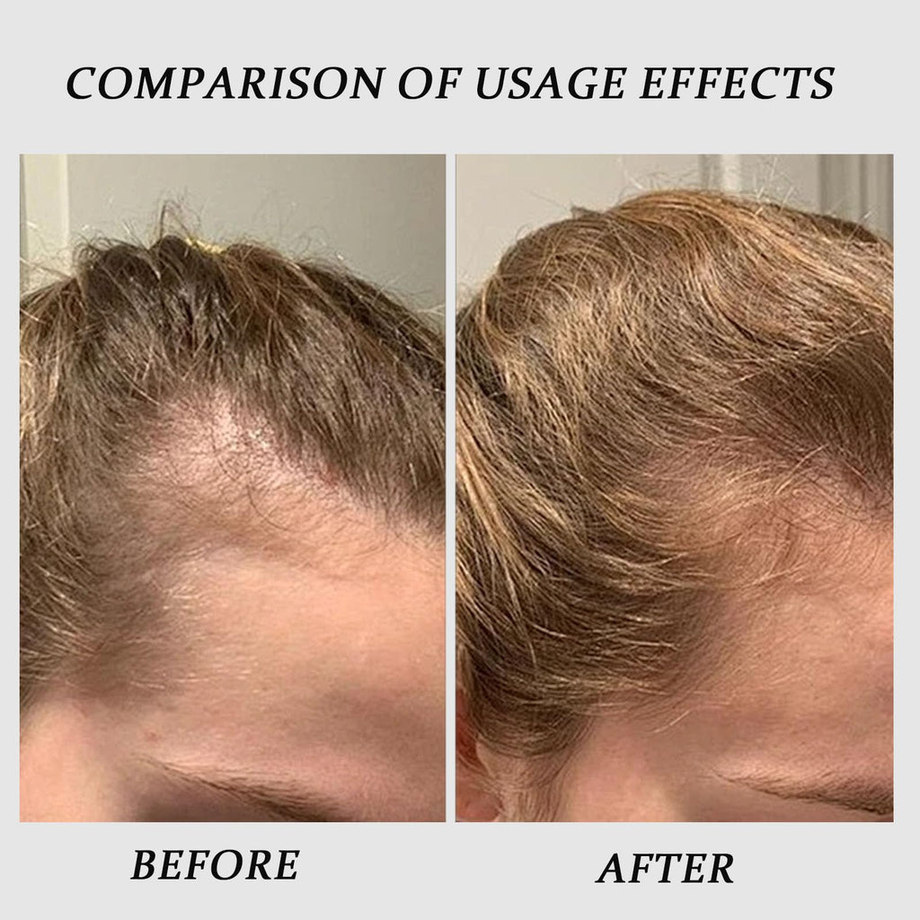QUZOYU Thicair Hair Regrowth System – Volumizing Serum with Copper Peptides & Collagen