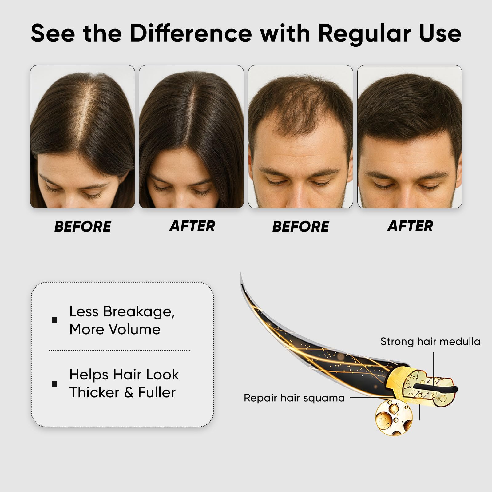 QUZOYU Thicair Hair Regrowth System – Volumizing Serum with Copper Peptides & Collagen