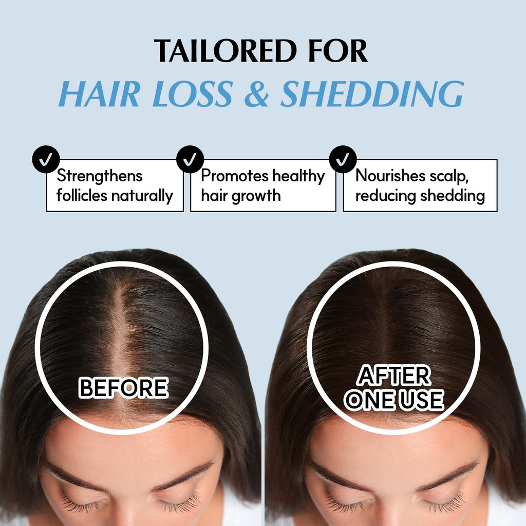 RATED GREEN Real Grow Anti Hair Loss Treatment | Rosemary Cream Shampoo for Thinning Hair – 6.76 fl oz