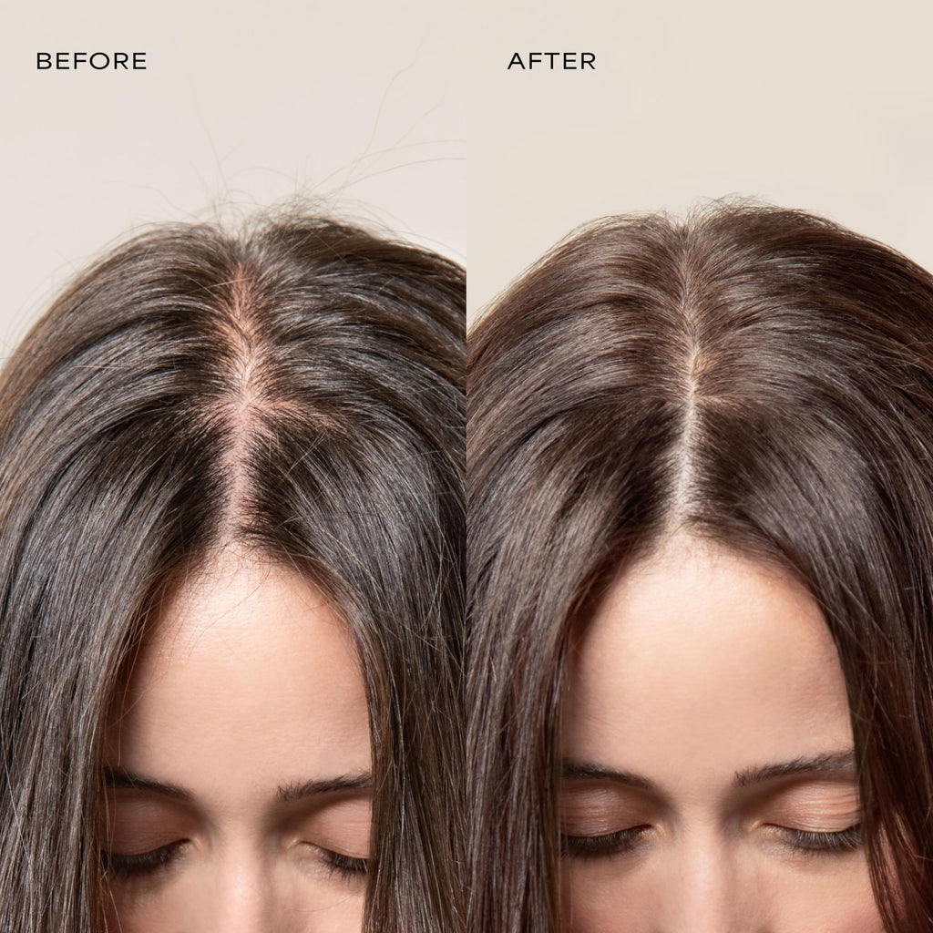 Raw Sugar Scalp Restore Shampoo & Conditioner Bundle – Jojoba, Aloe & Niacinamide | SLS/SLES & Paraben Free