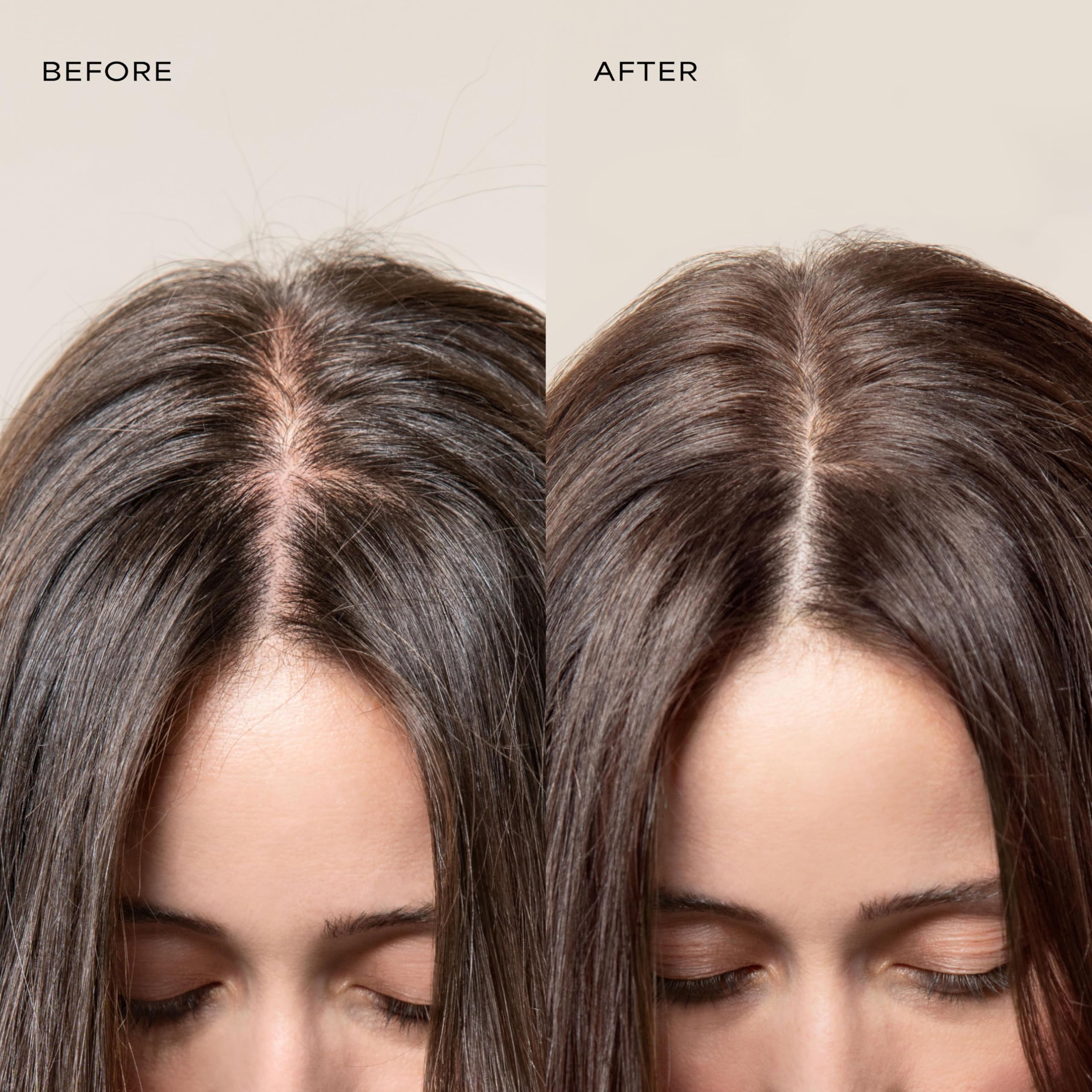 Raw Sugar Scalp Restore Shampoo & Conditioner Bundle – Jojoba, Aloe & Niacinamide | SLS/SLES & Paraben Free