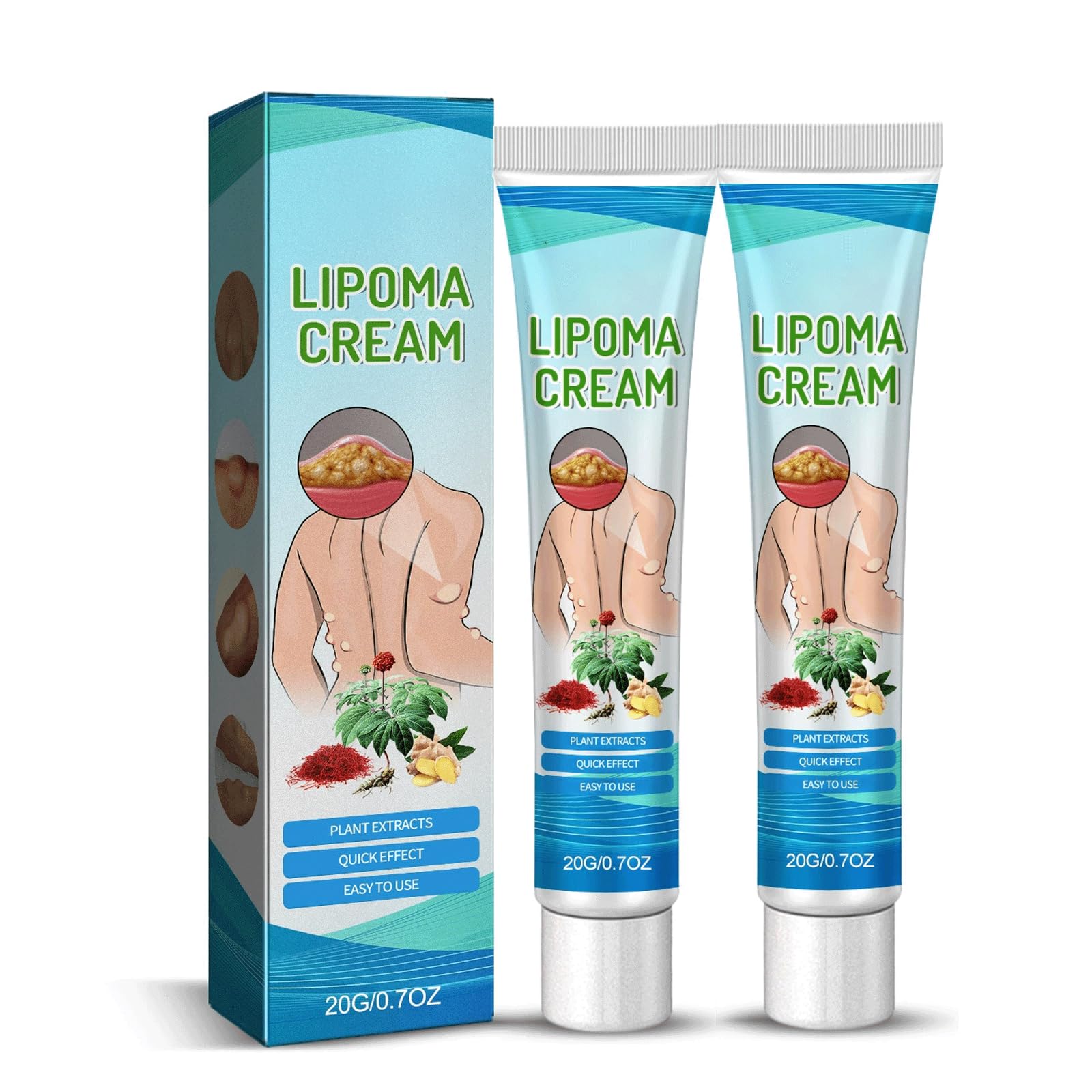 RCSCBC Lipoma Cream — Deep Moisturizing for Sensitive Skin (2 Pcs)