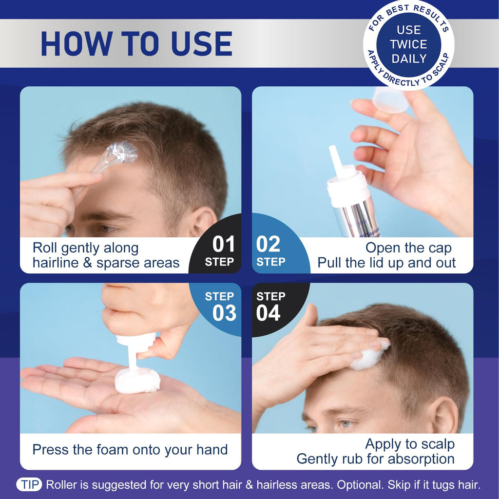 RDVHDLW 5% Minoxidil Foam for Hair Growth – Men & Women, 7-Month Supply (7x60ml)