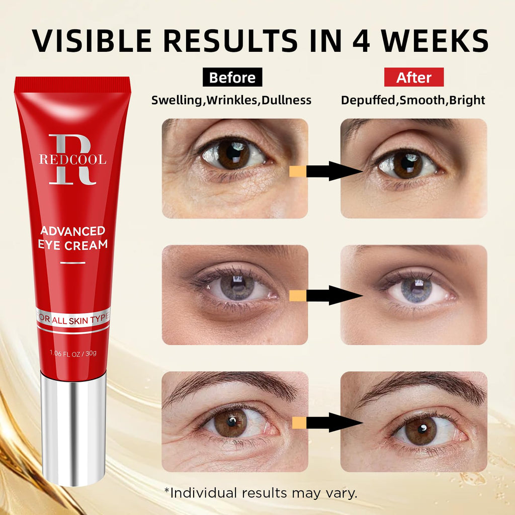 Redcool Retinol Eye Cream for Dark Circles – Hyaluronic Acid, Caffeine, Day and Night Use