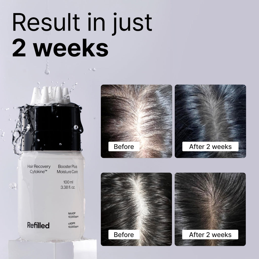Refilled Booster Plus Moisture – Hair Growth Serum & Thickening Scalp Treatment with Built-In Massager