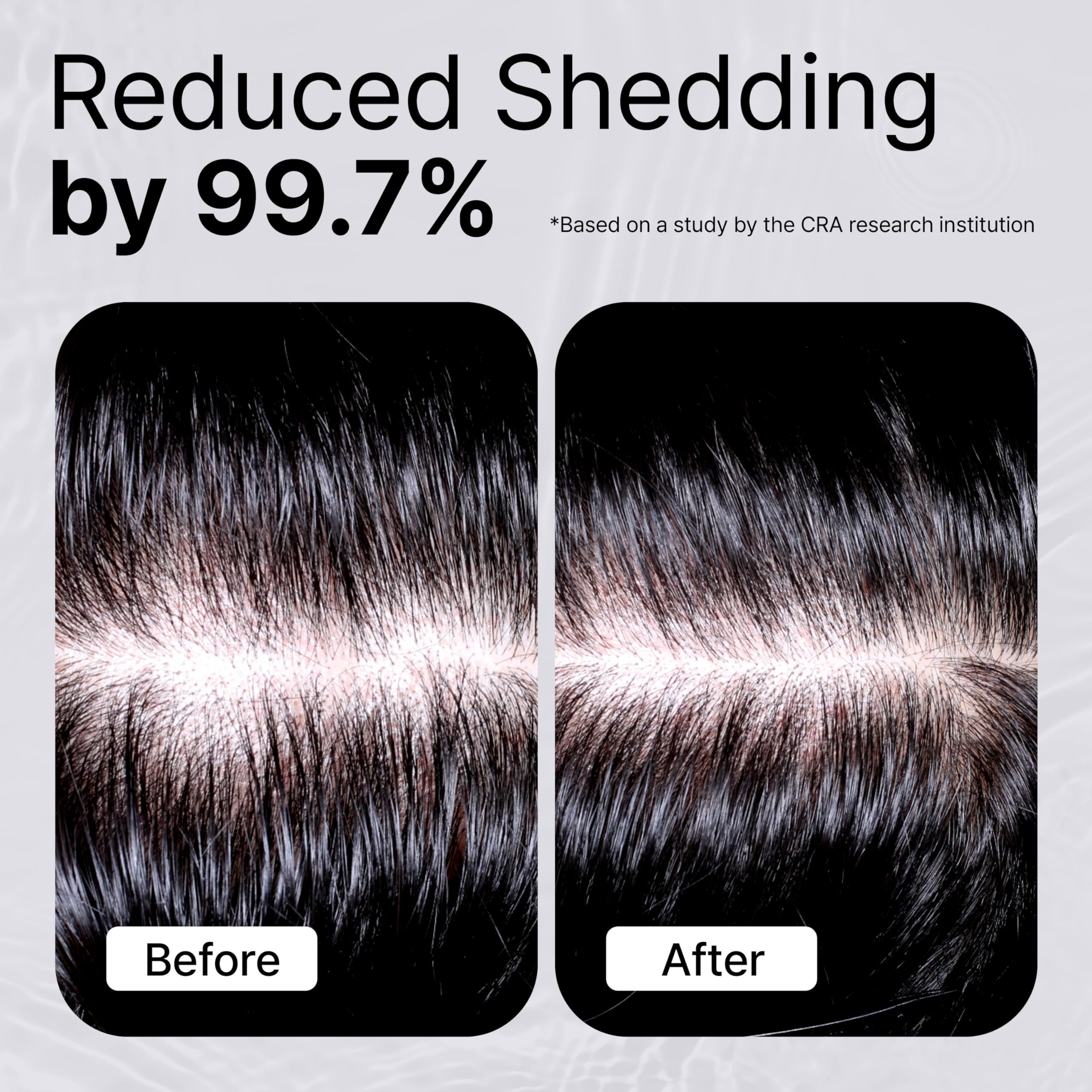 Refilled Booster Plus Moisture – Hair Growth Serum & Thickening Scalp Treatment with Built-In Massager