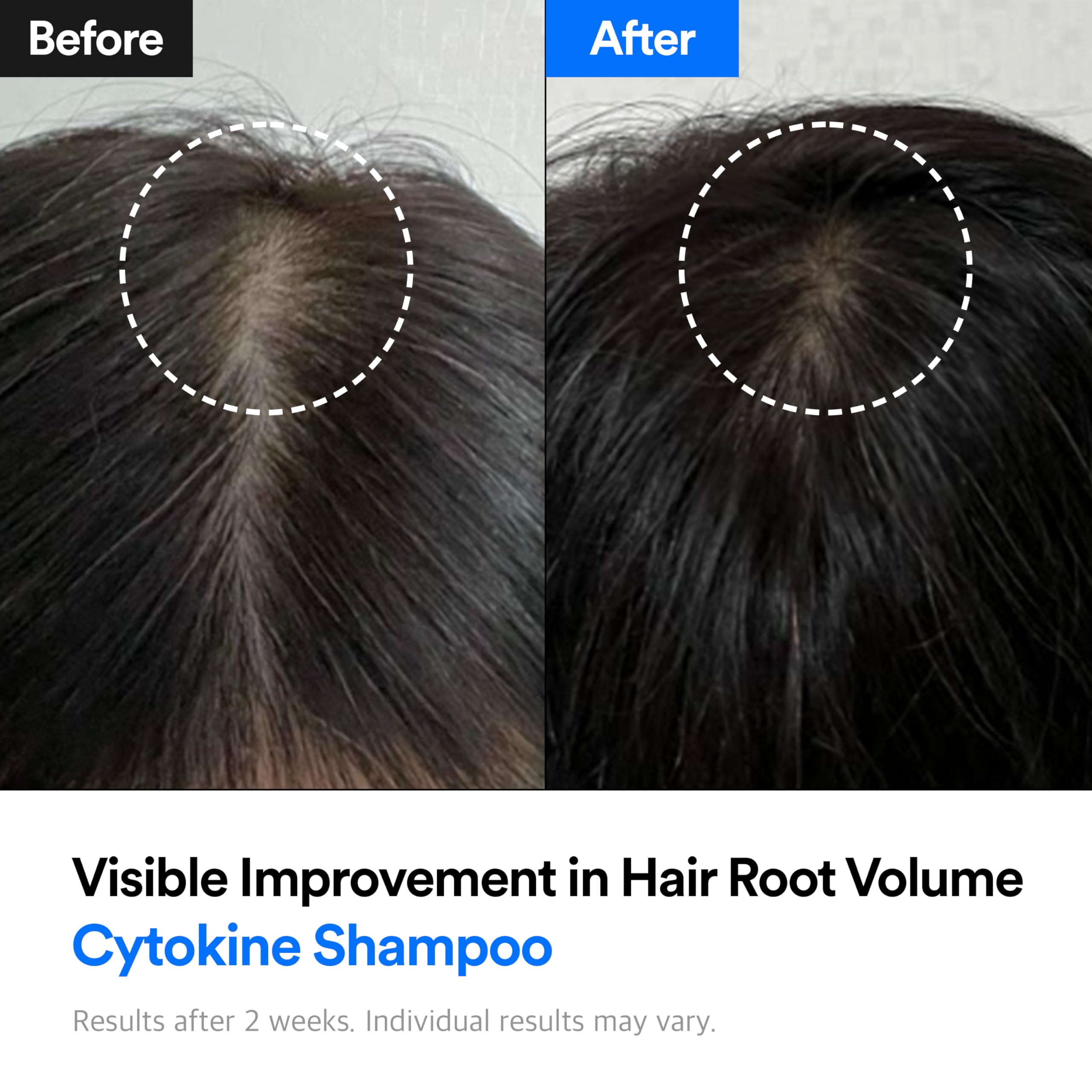 Refilled Hair-Recovery Cytokine Shampoo Plus Moisture Care – Sulfate-Free Thickening
