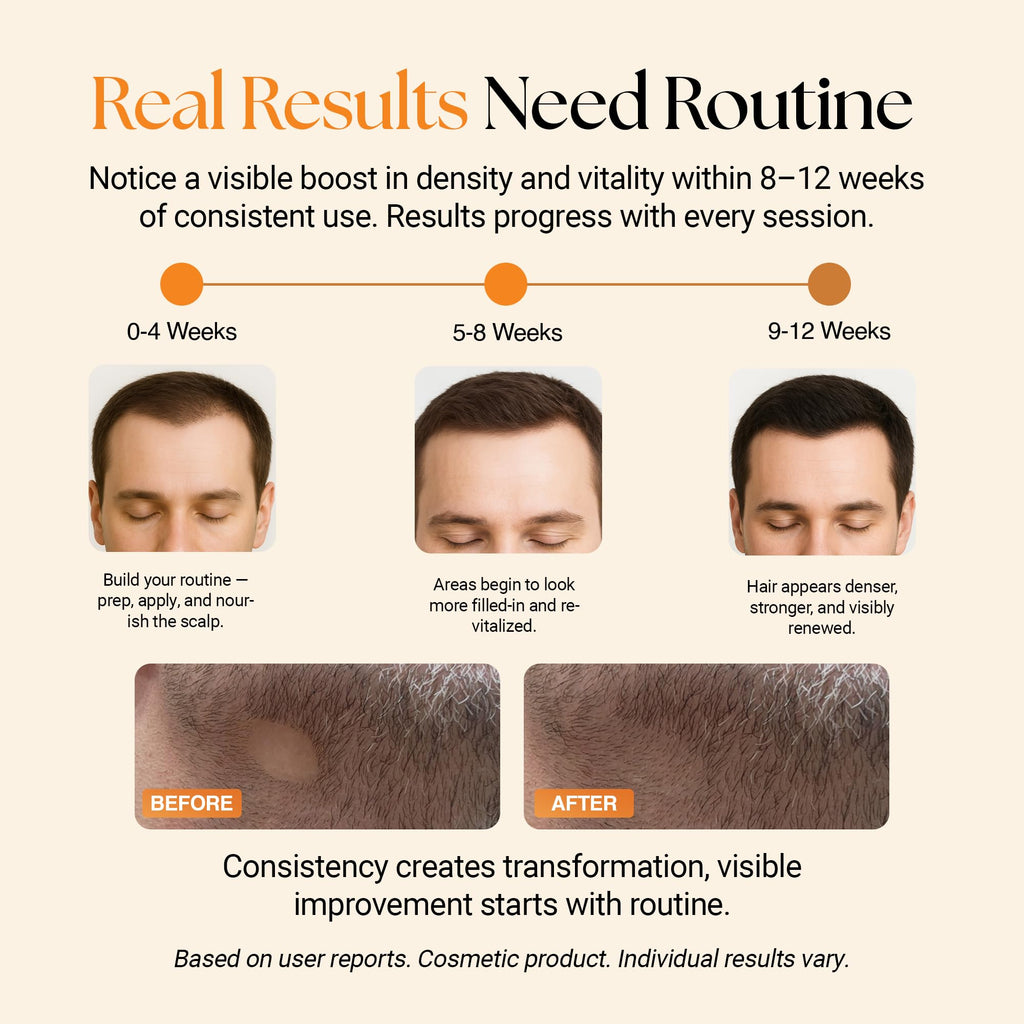 ReGlow Micro-Infusion Hair Density System | Precision Applicators & Bio-Active Serum