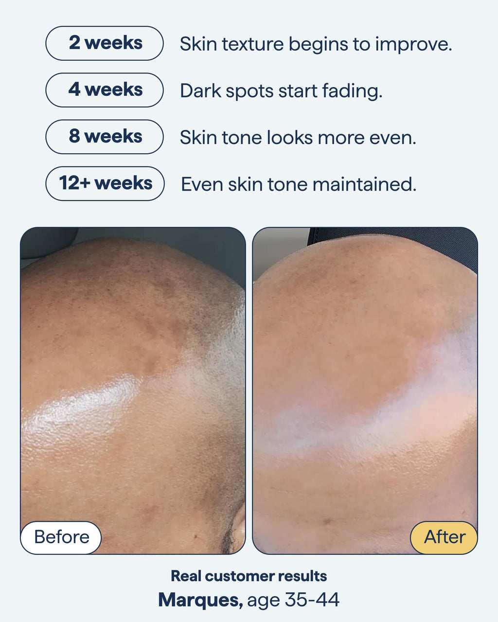 Remedy Science – Remedy for Dark Spots, Advanced Night Treatment with Retinol & Kojic Acid