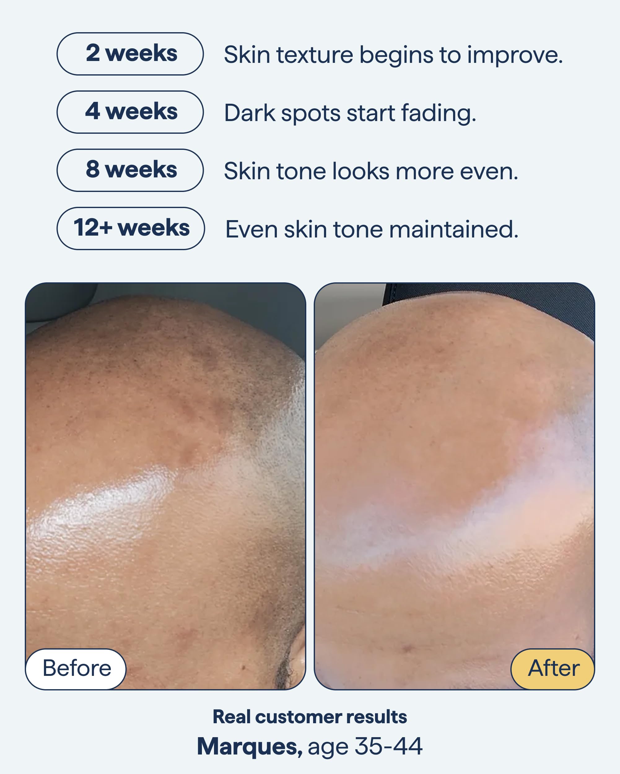 Remedy Science – Remedy for Dark Spots, Advanced Night Treatment with Retinol & Kojic Acid