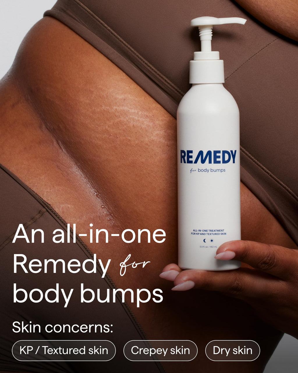 Remedy Science KP Exfoliating Body Moisturizer – Keratosis Pilaris Treatment by Dr. Shah