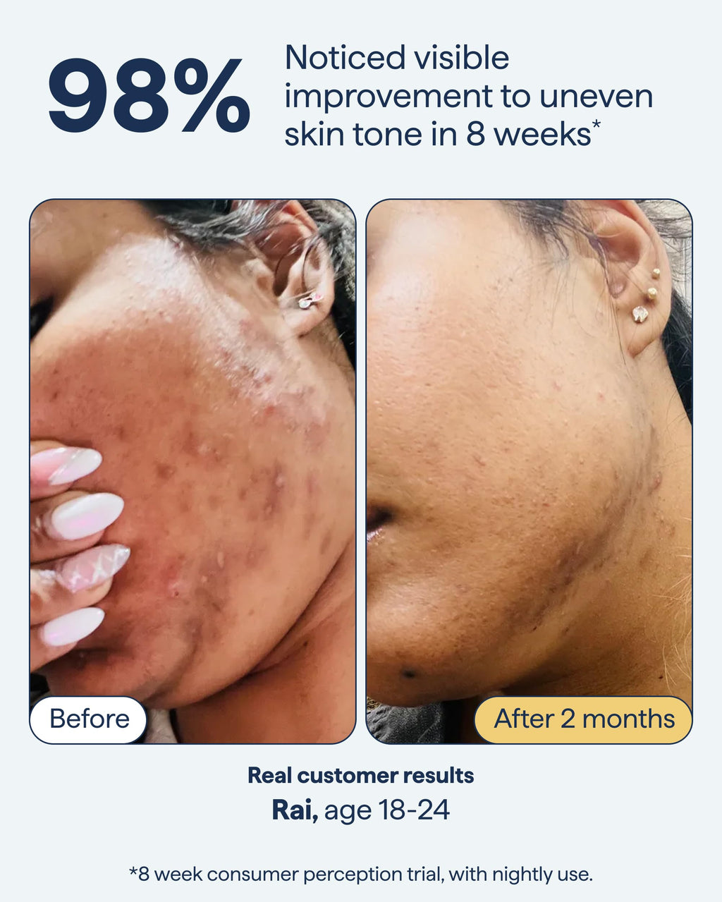 Remedy Science – Remedy for Dark Spots, Advanced Night Treatment with Retinol & Kojic Acid