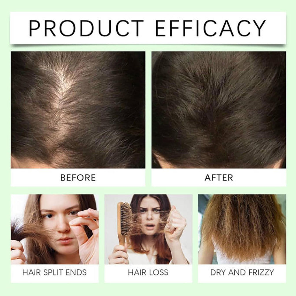 Remimpi Anti Hair Loss Shampoo – Plant-Powered Care for All Hair Types (2Pcs)