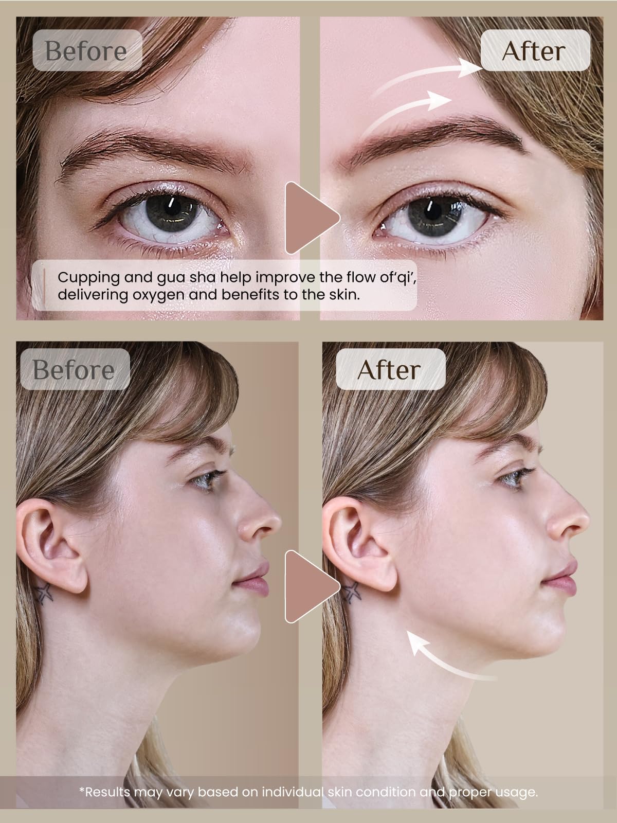 Rena Chris Facial Cupping Set & Gua Sha Tool – Silicone Cups + Obsidian Stone