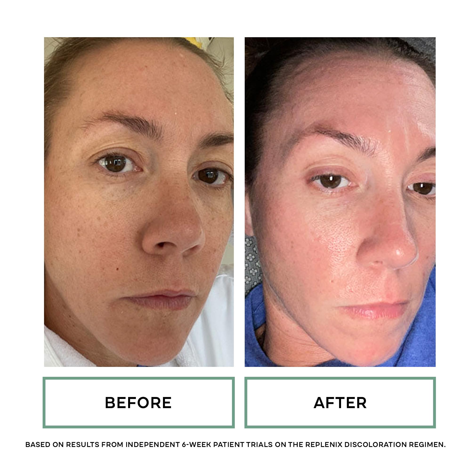Replenix Brightening Eye Cream | Medical-Grade Hydration for Dark Circles & Puffiness