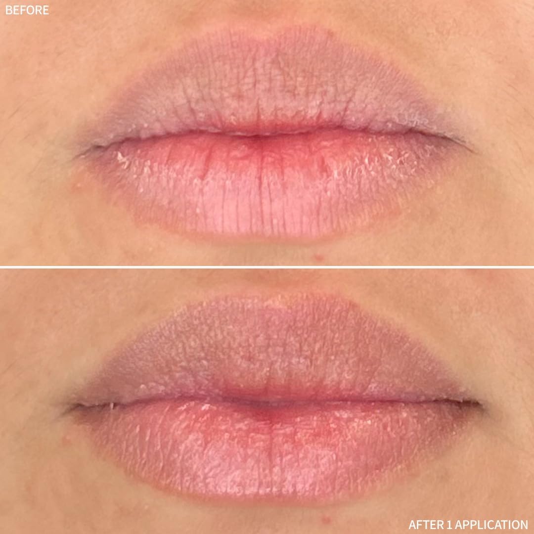 RescueMD Restorative Lip Treatment | Peptide-Powered Hydration & Arnica Repair (12mL)