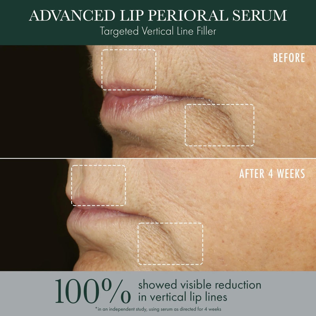 RéVive Advanced Perioral Lip Serum – Define, Plump & Brighten Lips (0.5 oz)