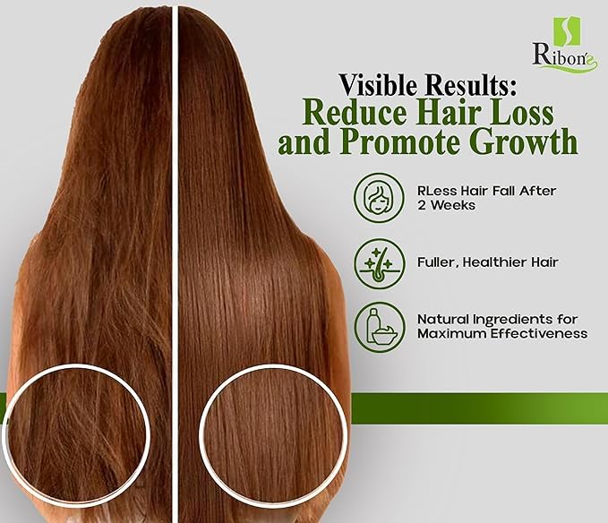 Ribon's Natural Shampoo & Hair Treatment Set – Onion, Rosemary & Aloe Vera – Pineapple Coconut Scent – 2x250ml