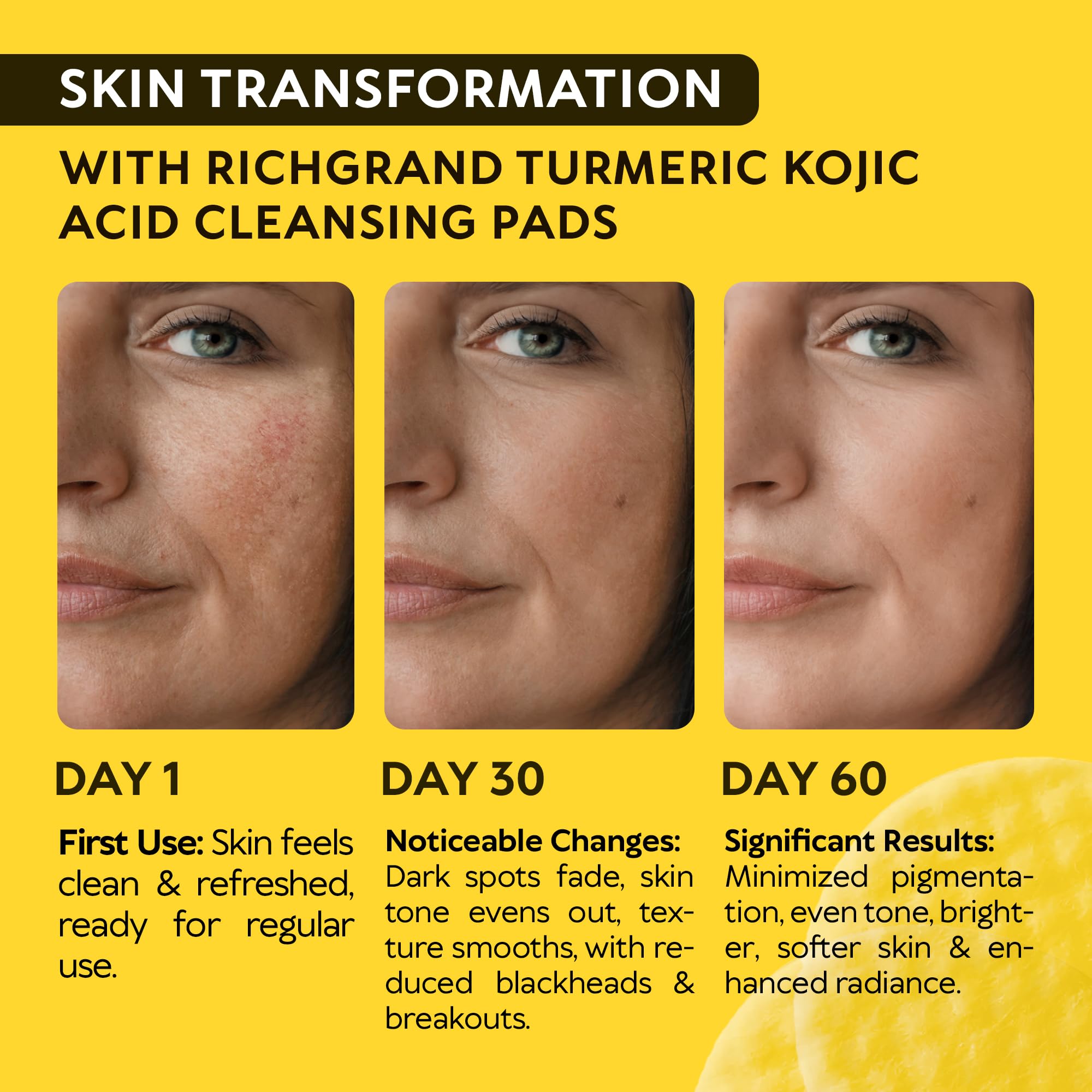 RichGrand Turmeric Kojic Cleansing Pads – Foaming Face Wash with Vitamin C & Lemon
