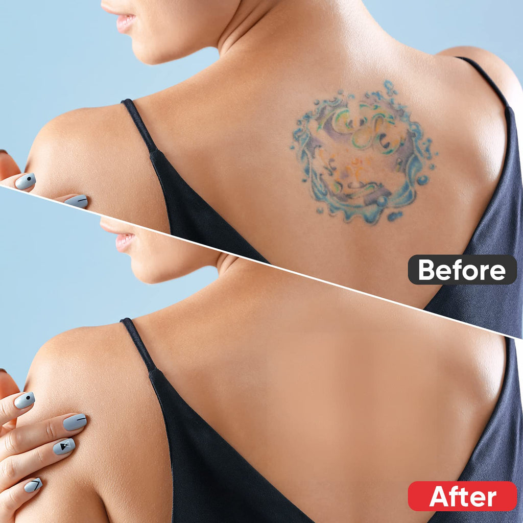 Tattoo Cover Up Tape - Invisible Waterproof & Breathable Concealer for Tattoos, Scars, Birthmarks | Richie House