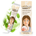 Richie House Vitiligo Cream – Natural Formula to Support Even Skin Tone