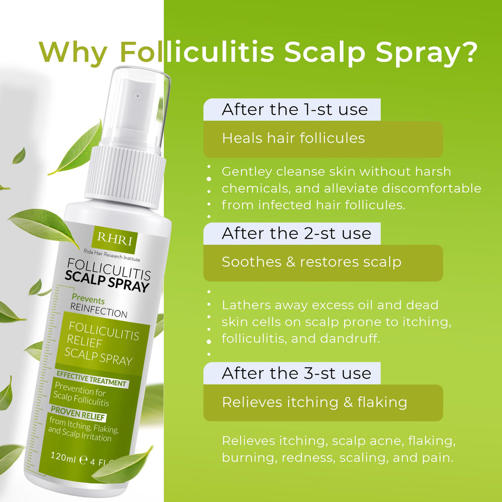Folliculitis Scalp Spray — Dandruff & Psoriasis Relief | Rida Hair Research Institute