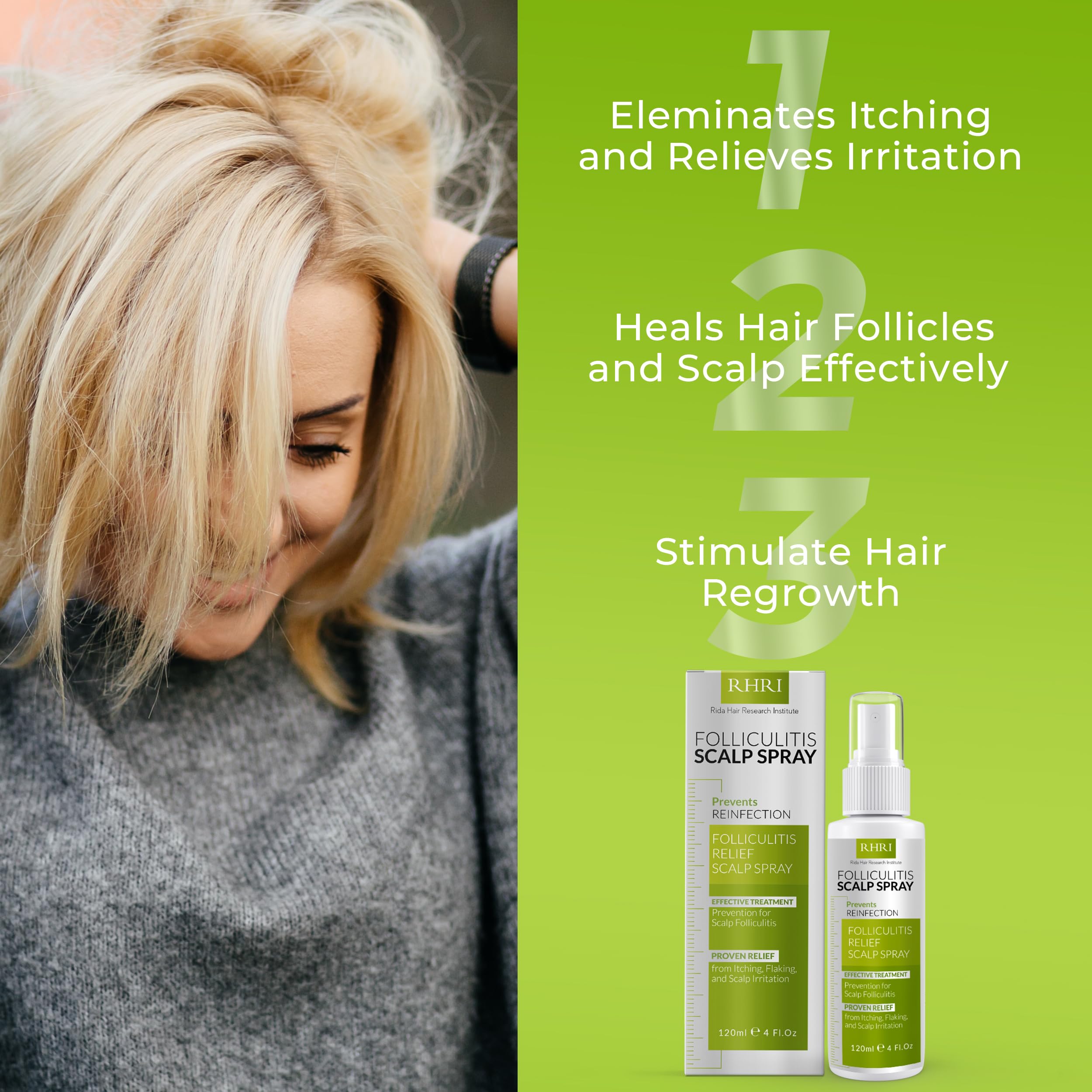 Folliculitis Scalp Spray — Dandruff & Psoriasis Relief | Rida Hair Research Institute