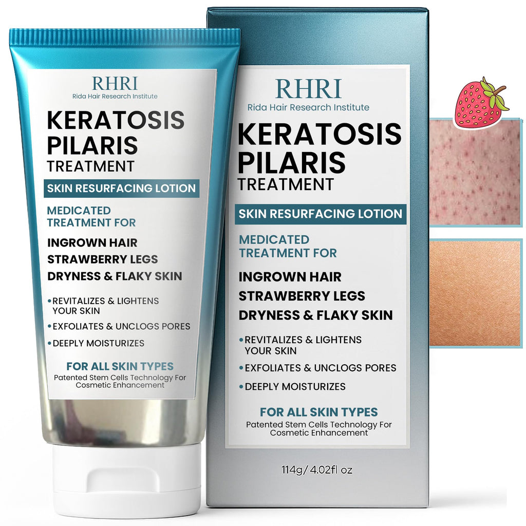 Rida Keratosis Pilaris Treatment – 10% AHA KP Lotion for Smooth, Hydrated Skin