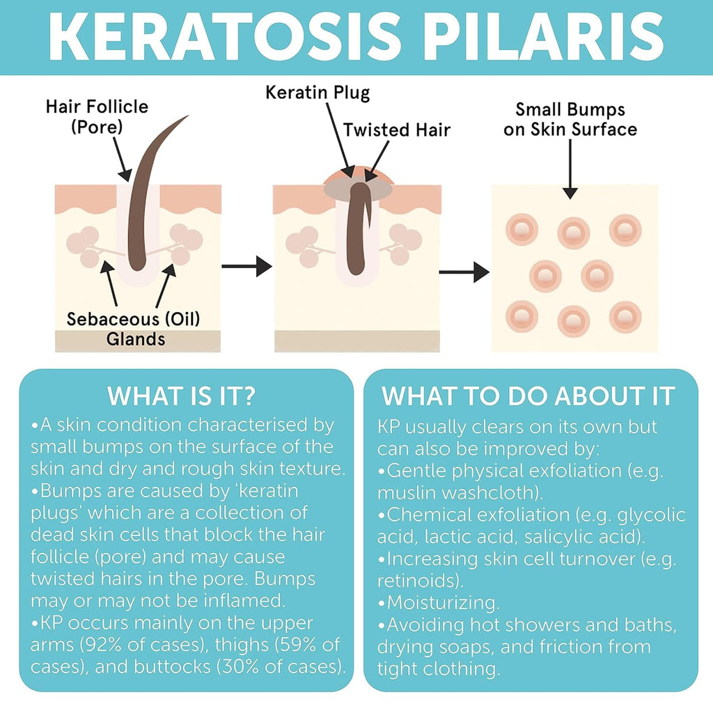 Rida Keratosis Pilaris Treatment – 10% AHA KP Lotion for Smooth, Hydrated Skin