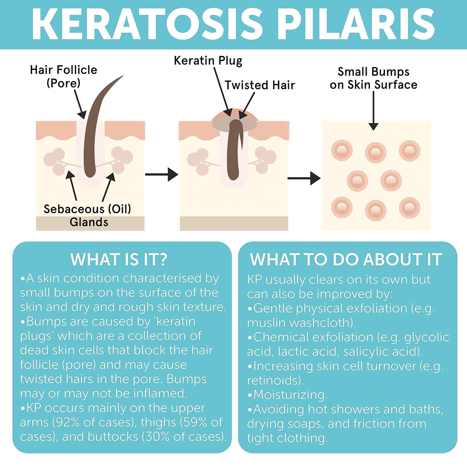 Rida Keratosis Pilaris Treatment – 10% AHA KP Lotion for Smooth, Hydrated Skin