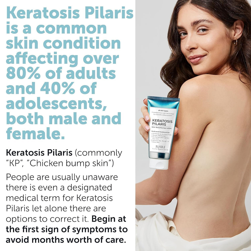 Rida Keratosis Pilaris Treatment – 10% AHA KP Lotion for Smooth, Hydrated Skin
