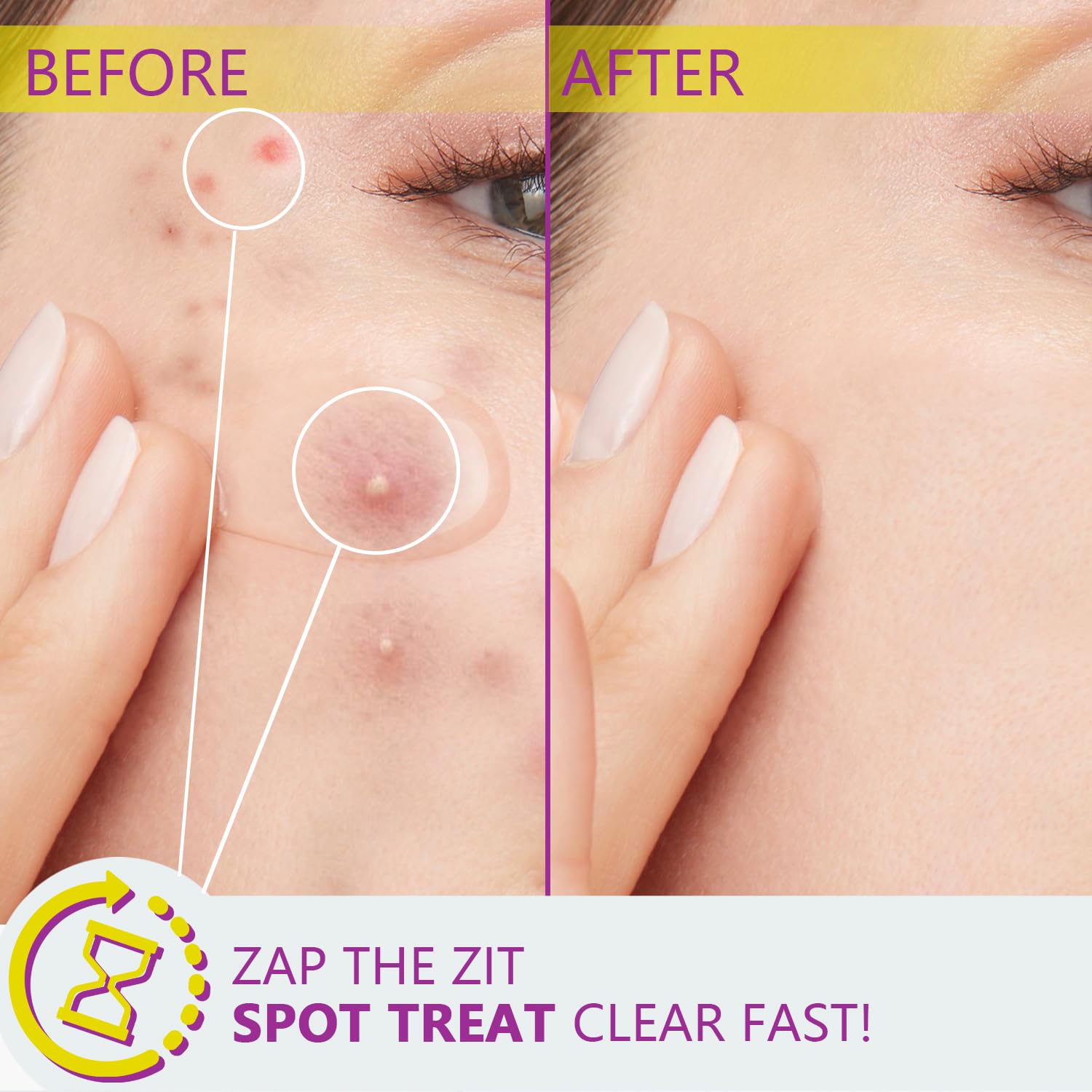 RIGBOO Azelaic Acid 12% Serum – Niacinamide & Hyaluronic Acid