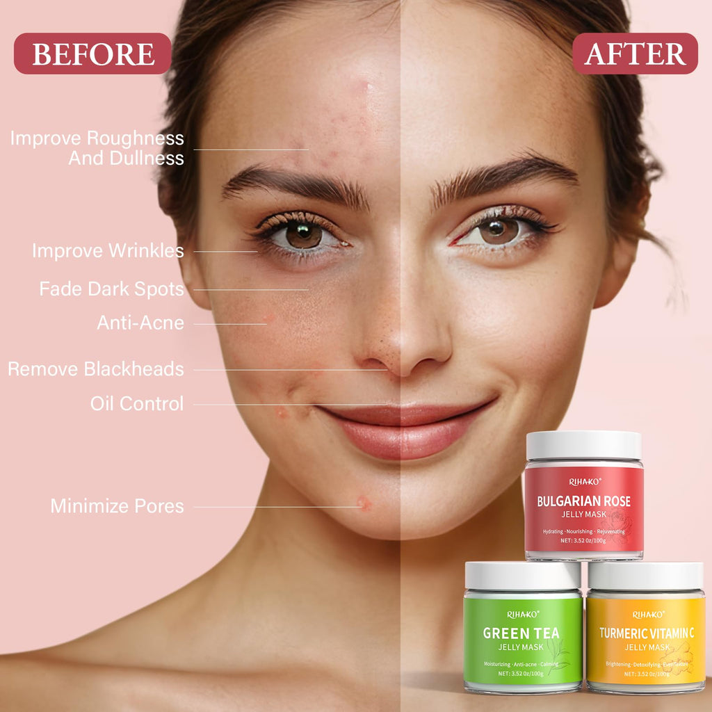 RIHAKO Jelly Mask Gift Kit – Turmeric Vitamin C, Rose & Green Tea Hydrating Face Masks
