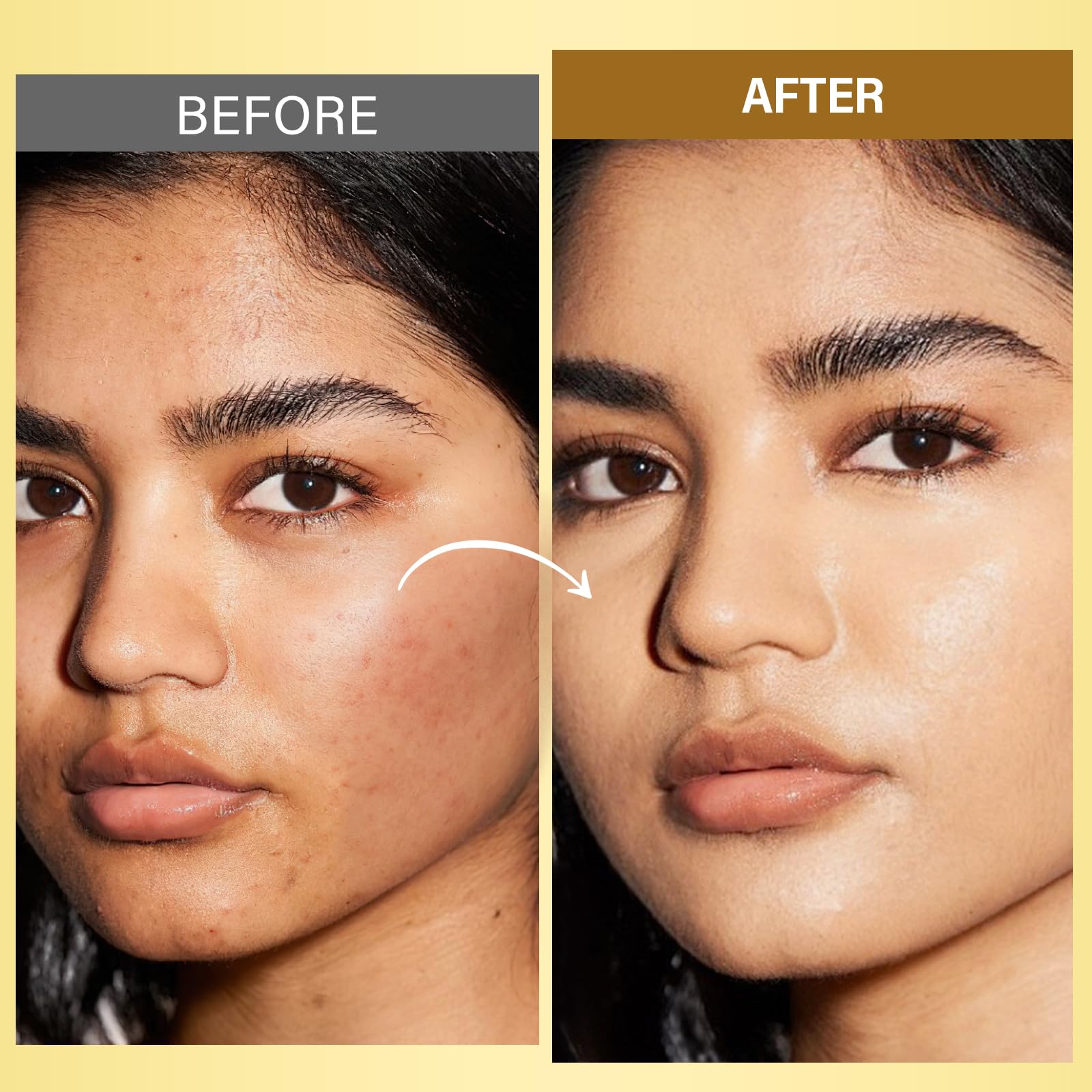 RIHAKO Turmeric Rosehip Face Oil for Gua Sha – Hydrating Anti-Aging Glow