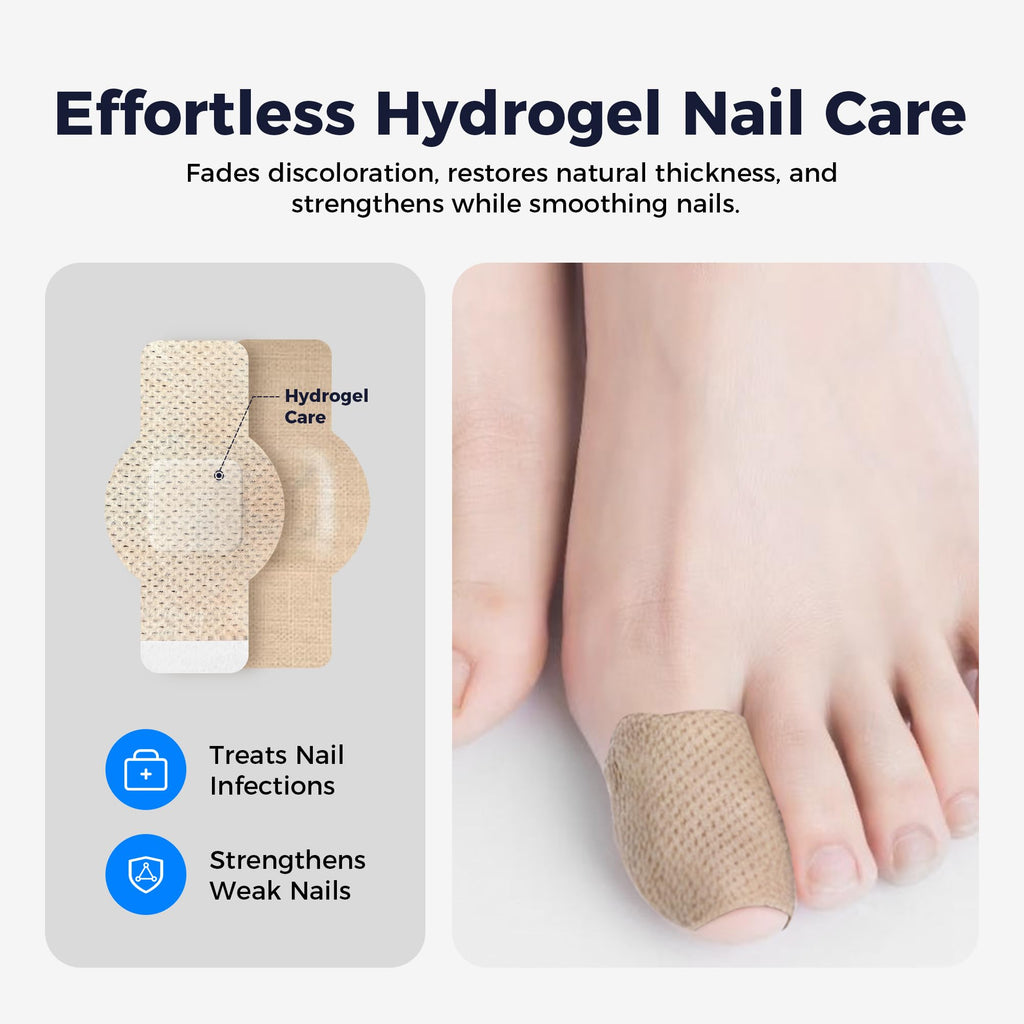 Rinlus Fungal Nail Patches & Nail Repair Pen – Fast-Acting 7-Day Toenail Treatment